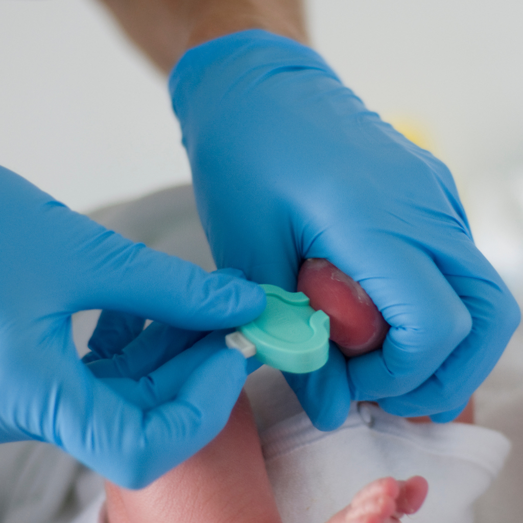 Momento em que o médico faz o teste do pezinho